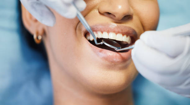 Best Emergency Gum Treatment in De Motte, IN