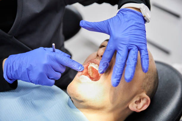 Best Emergency Tooth Extraction in De Motte, IN